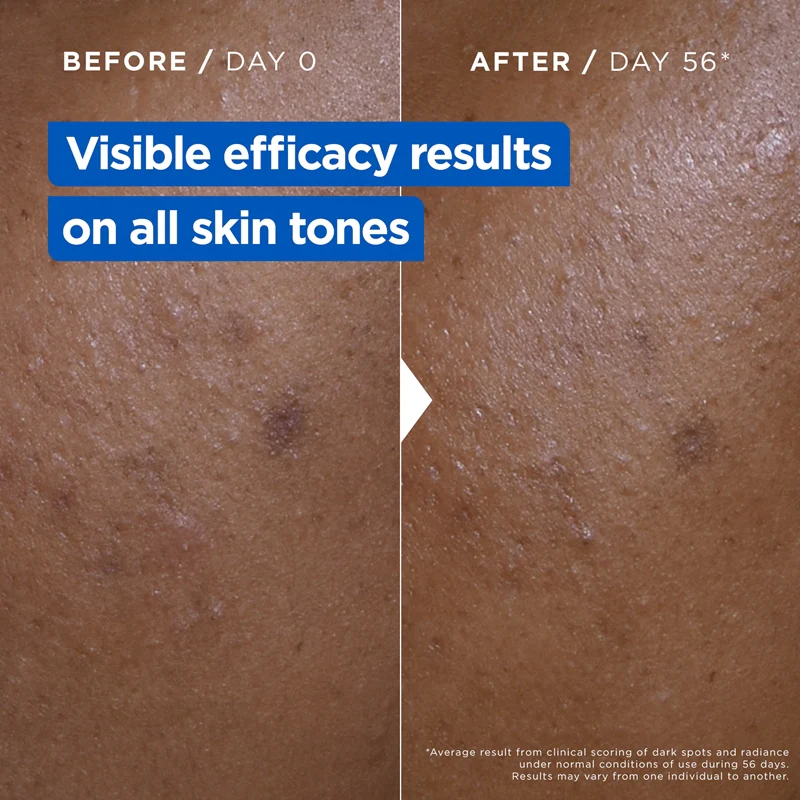 Crème NIACINAMIDE CORRECTION ECLAT 400ml - MIXA - Image 3